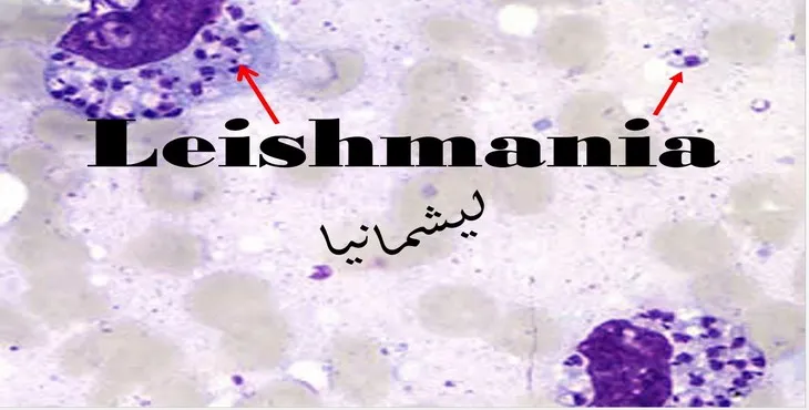 دانلود پاورپوینت لیشمانیا